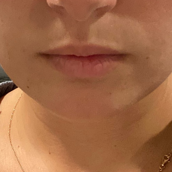 Lip Plumping Oil and Gloss Duo Kit - Picture 7 of 8